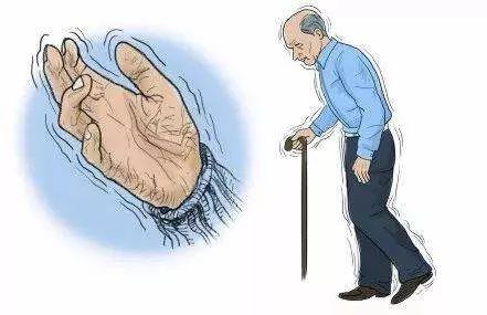 帕金森病的誤區(qū)，你知道嗎？