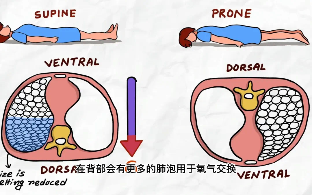 換個(gè)姿勢(shì)睡覺，竟然可以救命
